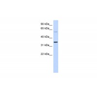Antibody used in WB on Human Lung at 0.2-1 ug/ml.