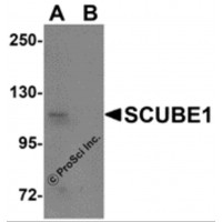 Western blot analysis of SCUBE1 in Daudi cell lysate with SCUBE1 antibody at 1 μg/mL in (A) the absence and (B) the presence of blocking peptide.