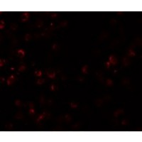 Immunofluorescence of SCUBE1 in Daudi cells with SCUBE1 antibody at 20 μg/mL.