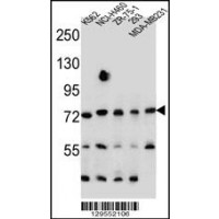 Western blot analysis in K562,NCI-H460,ZR-75-1,293,MDA-MB231 cell line lysates (35ug/lane).