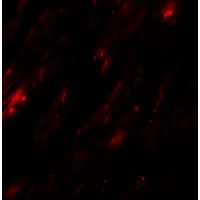 Immunofluorescence of SELK in human heart tissue with SELK antibody at 20 μg/mL.