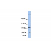 Antibody used in WB on Human HepG2 at 0.2-1 ug/ml.