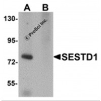 Western blot analysis of SESTD1 in rat brain tissue lysate with SESTD1 antibody at 1 μg/mL in (A) the absence and (B) the presence of blocking peptide.