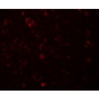 Immunofluorescence of SESTD1 in Human Brain cells with SESTD1 antibody at 20 μg/mL.
