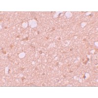 Immunohistochemistry of SESTD1 in human brain tissue with SESTD1 antibody at 5 μg/mL.