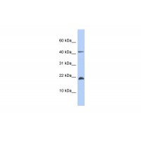 Antibody used in WB on Human Muscle at 0.2-1 ug/ml.