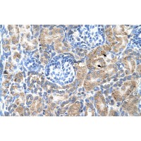 Antibody used in IHC on Human kidney.