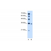 Antibody used in WB on Human HepG2 at 2.5 ug/ml.