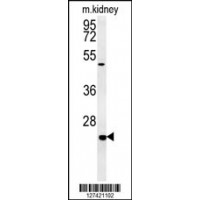 Western blot analysis in mouse kidney tissue lysates (15ug/lane).This demonstrates the detected SHISA2 protein (arrow).
