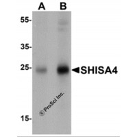 Western blot analysis of SHISA4 in human brain tissue lysate with SHISA4 antibody at (A) 1 and (B) 2 μg/mL.