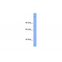 Antibody used in WB on Human Thymus at 0.2-1 ug/ml.