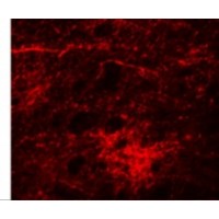 Immunofluorescence of SIPA1L3 in Human Brain cells with SIPA1L3 antibody at 20 μg/mL.