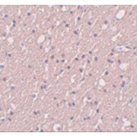 Immunohistochemistry of SIPA1L3 in human brain tissue with SIPA1L3 antibody at 5 μg/mL.