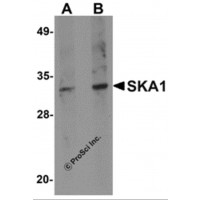 Western blot analysis of SKA1 in A549 cell lysate with SKA1 antibody at (A) 0.5 and (B) 1 μg/mL.