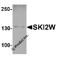Western blot analysis of SKI2W in mouse stomach tissue lysate with SKI2W antibody at 1 μg/ml.