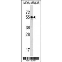 Western blot analysis in MDA-MB435 cell line lysates (35ug/lane).