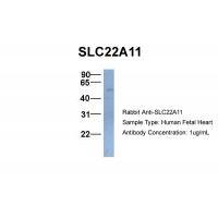 Antibody used in WB on Hum. Fetal Heart at 1 ug/ml.