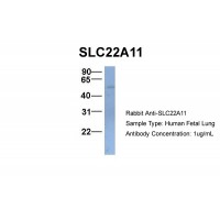 Antibody used in WB on Hum. Fetal Lung at 1 ug/ml.