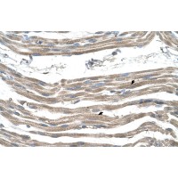 Antibody used in IHC on Human Muscle.