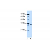 Antibody used in WB on Human HepG2 at 0.2-1 ug/ml.