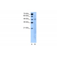 Antibody used in WB on Human Jurkat 5.0 ug/ml.