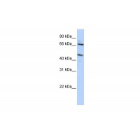 Antibody used in WB on Human HepG2 at 0.2-1 ug/ml.