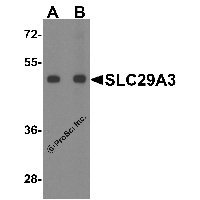 Western blot analysis of SLC29A3 in mouse bladder tissue lysate with SLC29A3 antibody at (A) 1 and (B) 2 μg/ml.