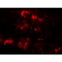Immunofluorescence of SLC29A3 in rat colon muscle tissue with SLC29A3 antibody at 20 μg/mL.