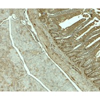 Immunohistochemistry of SLC29A3 in rat colon tissue with SLC29A3 antibody at 5 μg/mL.