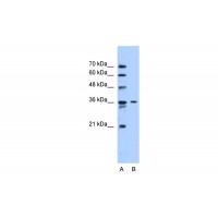 Antibody used in WB on Human HepG2 at 0.2-1 ug/ml.