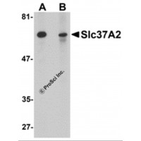 Western blot analysis of Slc37A2 in mouse spleen tissue lysate with Slc37A2 antibody at 1 μg/mL in the (A) absence and (B) presence of blocking peptide.