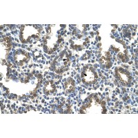 Antibody used in IHC on Human Lung.