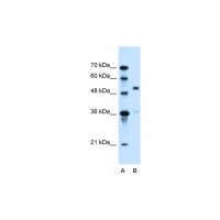 Antibody used in WB on Human HepG2 at 0.2-1 ug/ml.