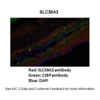 Antibody used in IHC on Mouse retina at s 1:200.