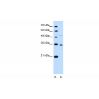 Antibody used in WB on Human HepG2 at 0.2-1 ug/ml.