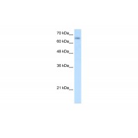 Antibody used in WB on Human Jurkat 0.2-1 ug/ml.