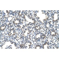Antibody used in IHC on Human Lung.