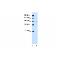 Antibody used in WB on Human Jurkat cells at 2.5 ug/ml.