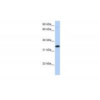 Antibody used in WB on Human HeLa at 0.2-1 ug/ml.