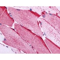 Immunohistochemistry staining of SLC5A10 in skeletal muscle tissue using SLC5A10 Antibody.