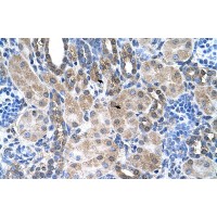 Antibody used in IHC on Human kidney.