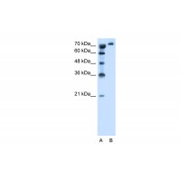 Antibody used in WB on Human Jurkat 1.25 ug/ml.