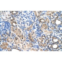 Antibody used in IHC on Human kidney.