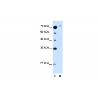 Antibody used in WB on Human Jurkat 2.5 ug/ml.