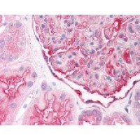 Immunohistochemistry staining of SLC7A2 in kidney (formalin-fixed paraffin embedded) tissue using SLC7A2 Antibody.