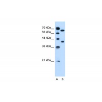 Antibody used in WB on Human Jurkat 0.2-1 ug/ml.