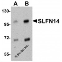 Western blot analysis of SLFN14 in mouse kidney tissue lysate with SLFN14 antibody at (A) 1 and (B) 2 μg/mL.