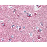 Human brain cortex tissue stained with SNAP alpha/beta (NAPA/NAPB) Antibody at 10 μg/mL followed by biotinylated anti-mouse IgG secondary antibody, alkaline phosphatase-streptavidin and chromogen.