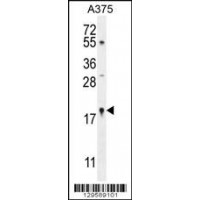 Western blot analysis in A375 cell line lysates (35ug/lane).