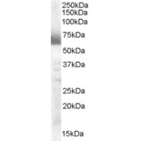 Western Blot (0.3μg/ml) staining of human ovary lysate (35μg protein in RIPA buffer). Primary incubation was 1 hour. Detected by chemiluminescence.